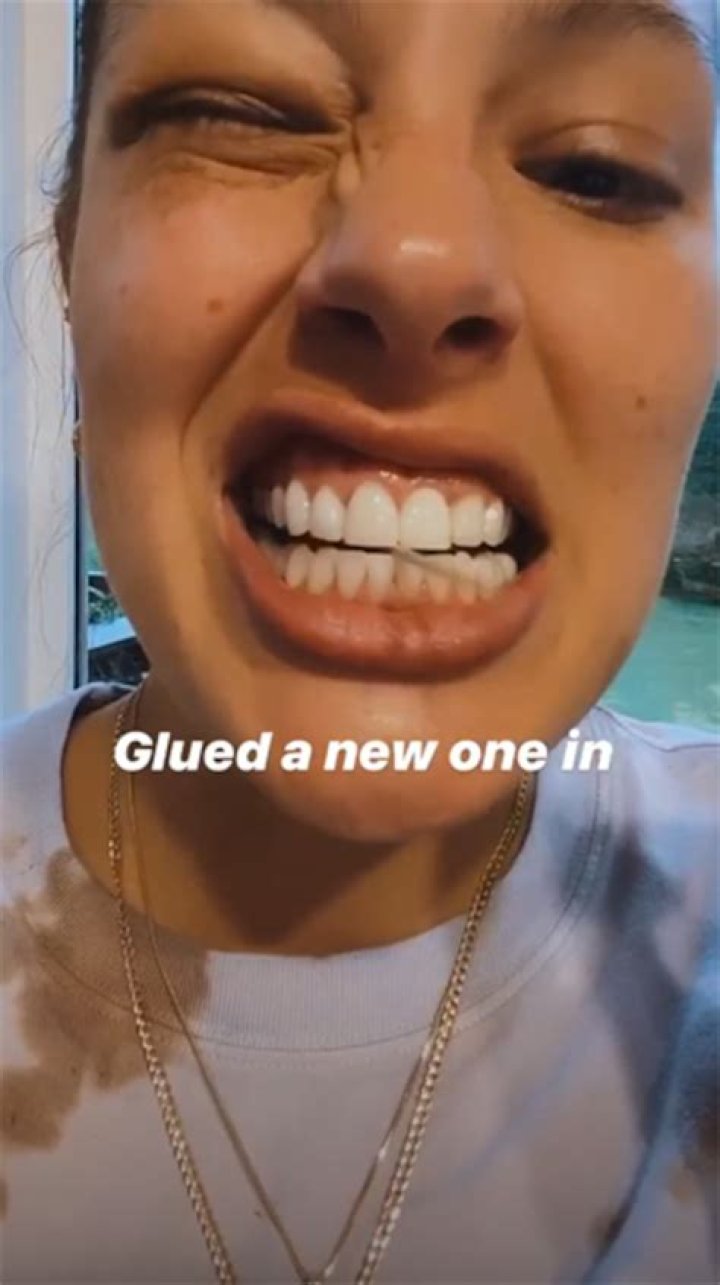 	Ashley Graham broke off her front tooth biting into a frozen cookie	