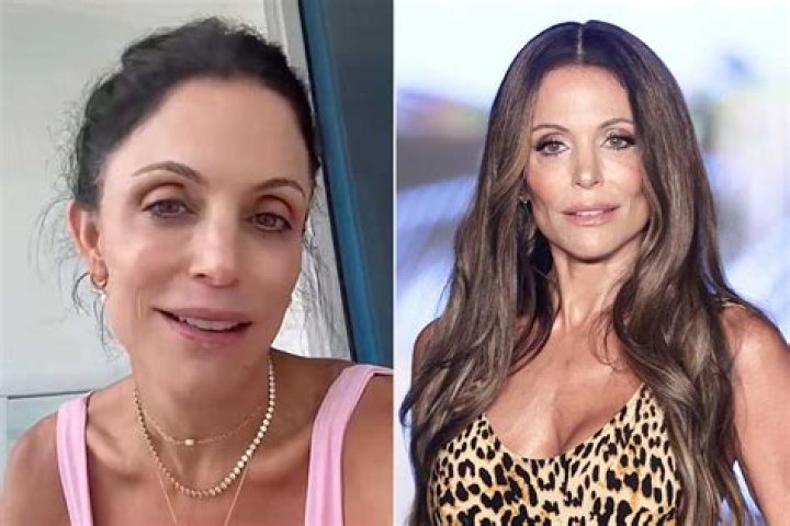 Bethenny Frankel looks different now: is it fillers or something else?
