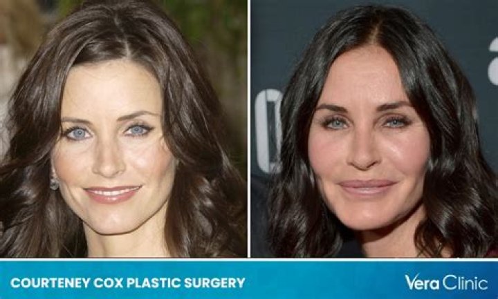 Courteney Cox on plastic surgery: ‘I’m open to trying to prolong the inevitable’