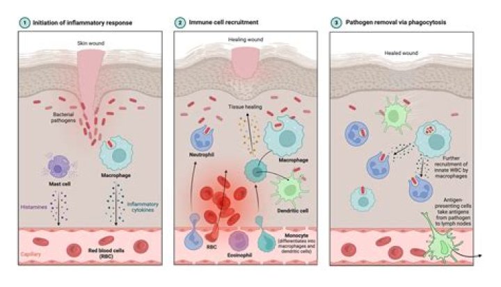 How does the inflammatory response help maintain homeostasis?