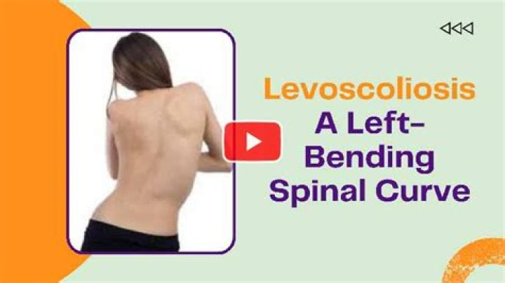 How serious is Levoscoliosis?
