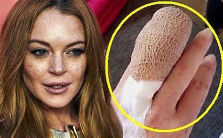 Lindsay Lohan needed her fingertip reattached after gruesome boat injury