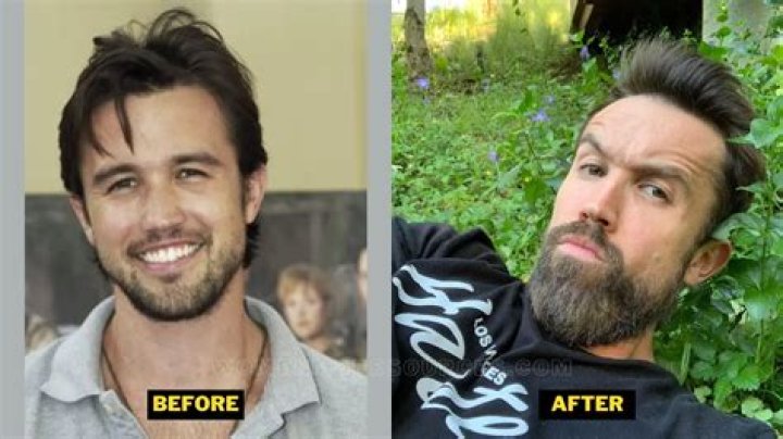 Rob McElhenney’s Weight Loss Journey And Reasons With His Before And After Photos