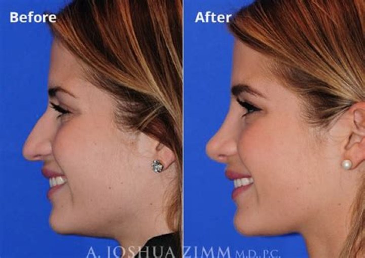 Southern Charm’s Naomie Olindo got a new nose: ‘Plastic surgery shouldn’t be taboo’