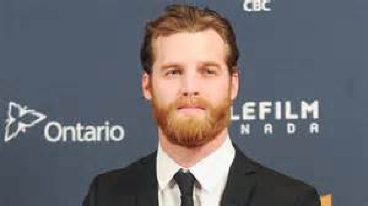 What Happened To Jared Keeso’s Tooth? Find Out About The Actors Injury