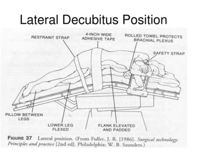 What is lateral decubitus position?